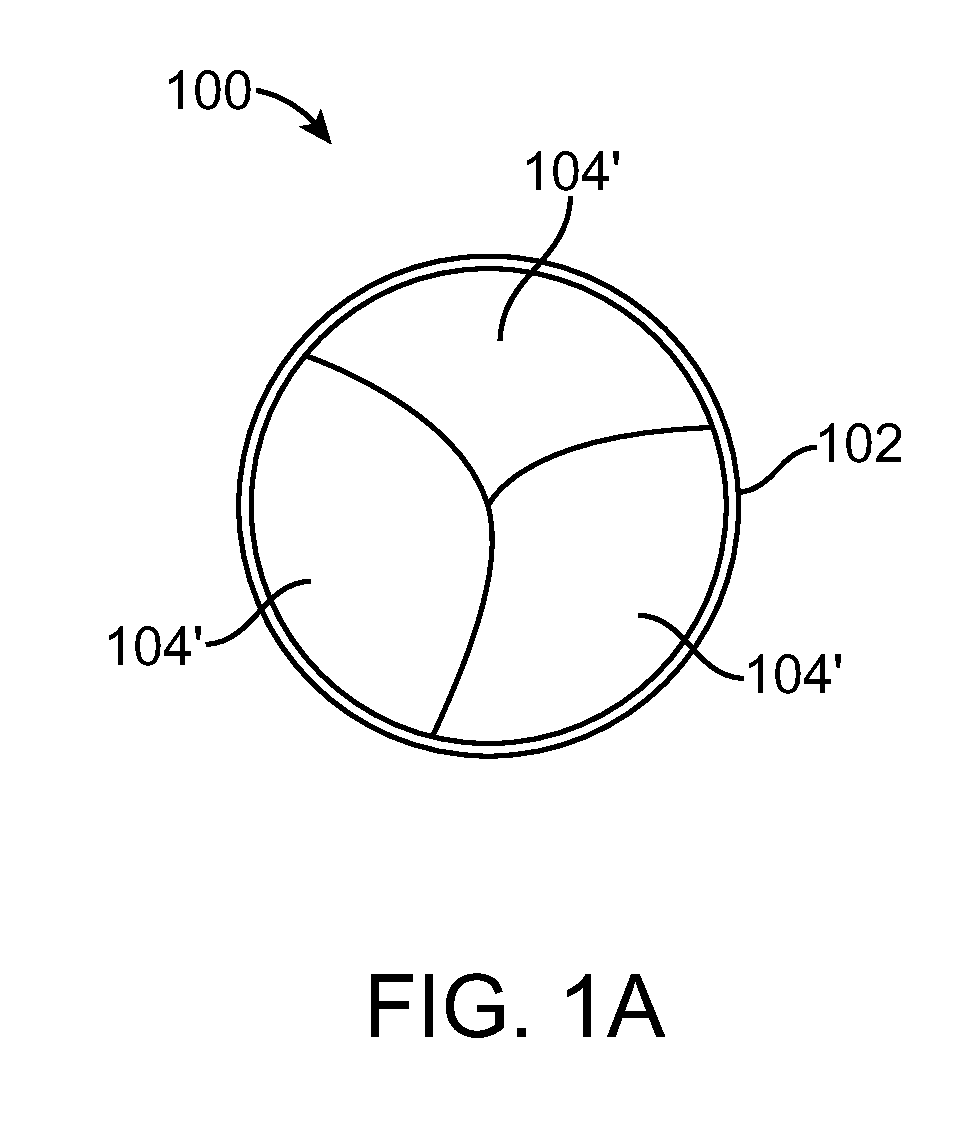 Prosthetic Valve With Device for Restricting Expansion