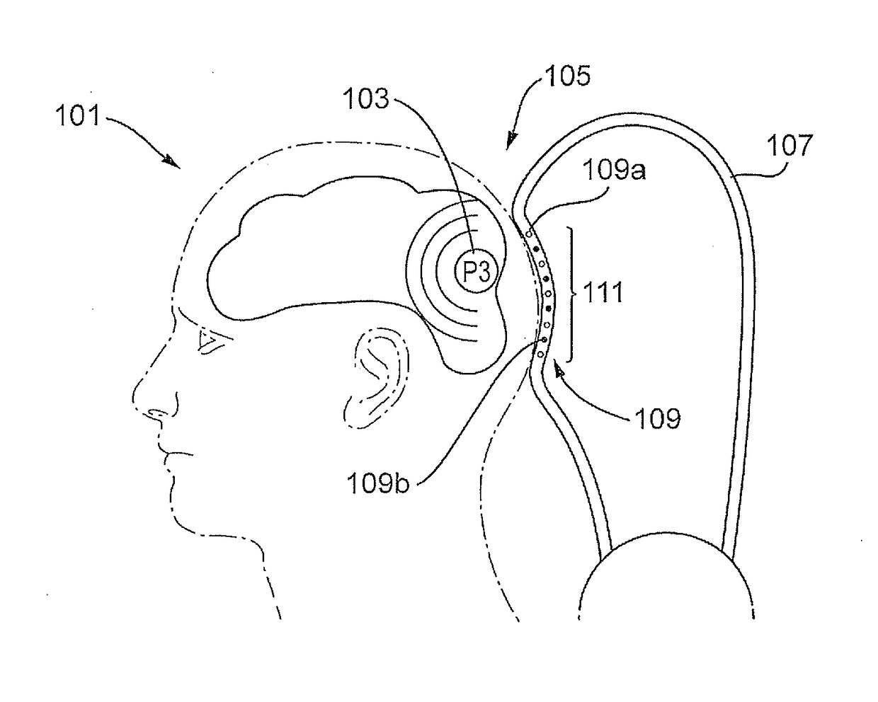 Transcranial neurostimulation system for a vehicle