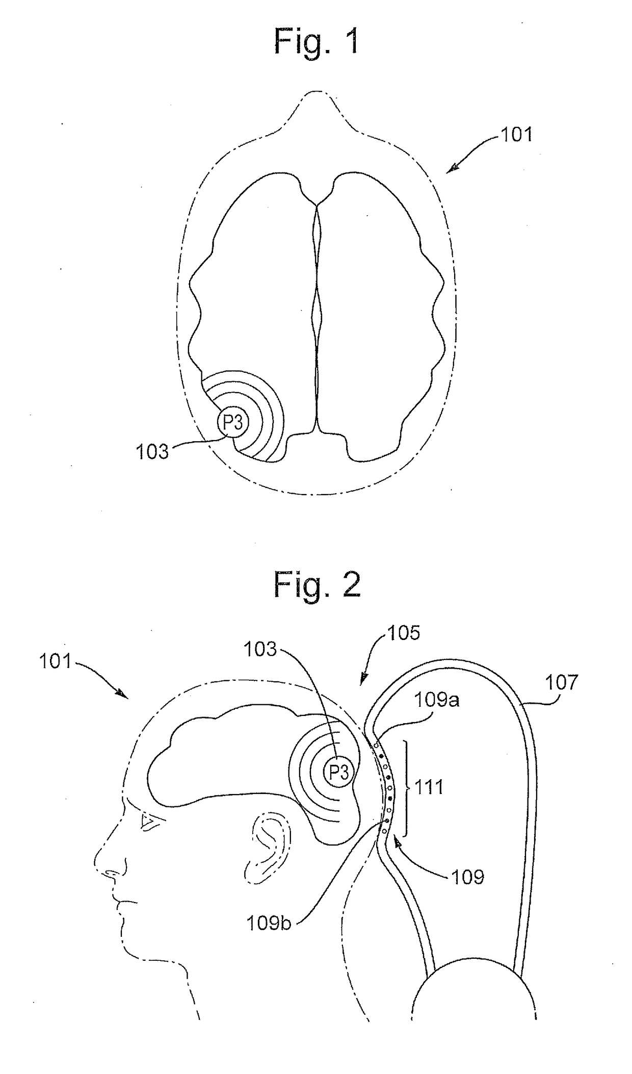 Transcranial neurostimulation system for a vehicle