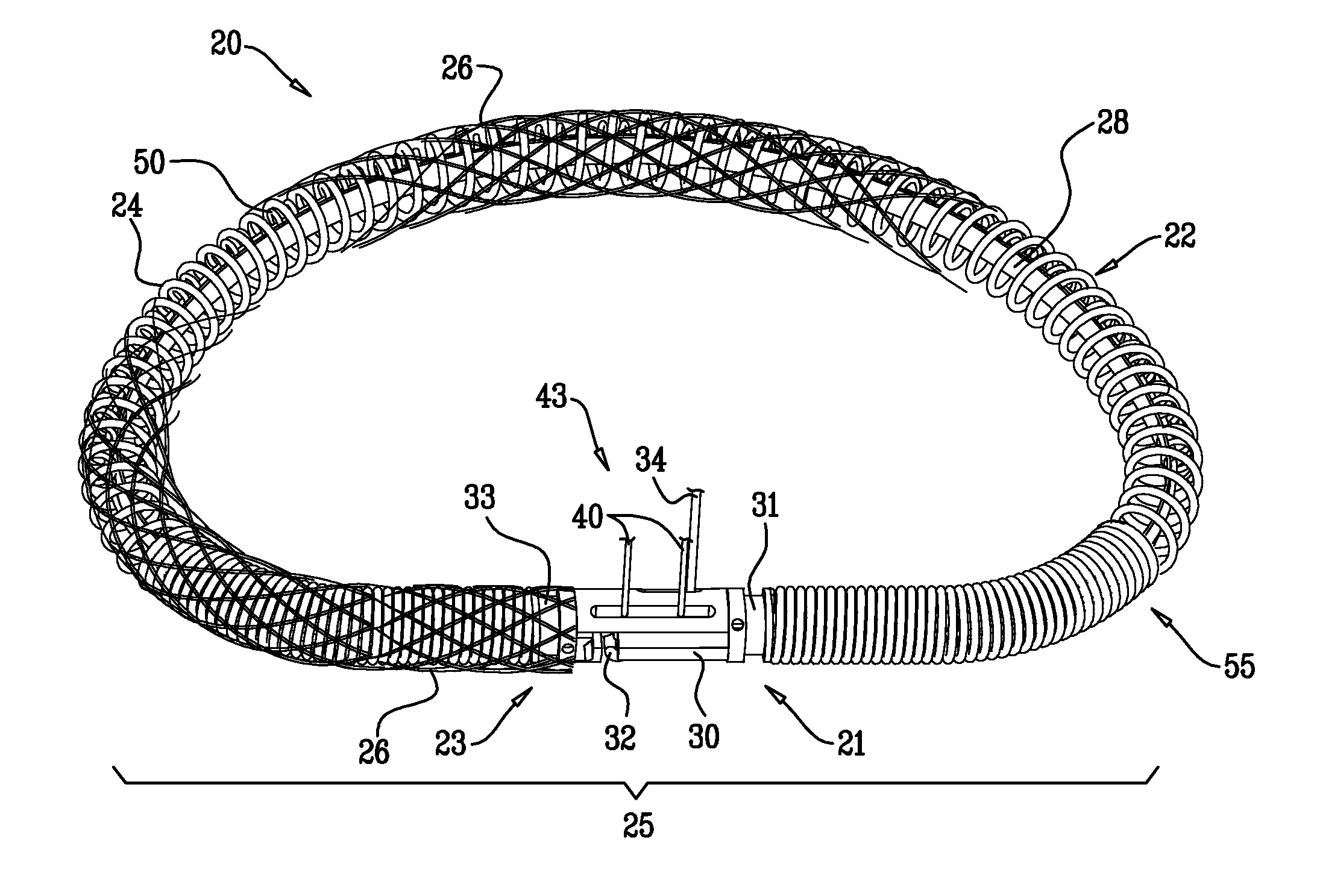 Actively-engageable movement-restriction mechanism for use with an annuloplasty structure