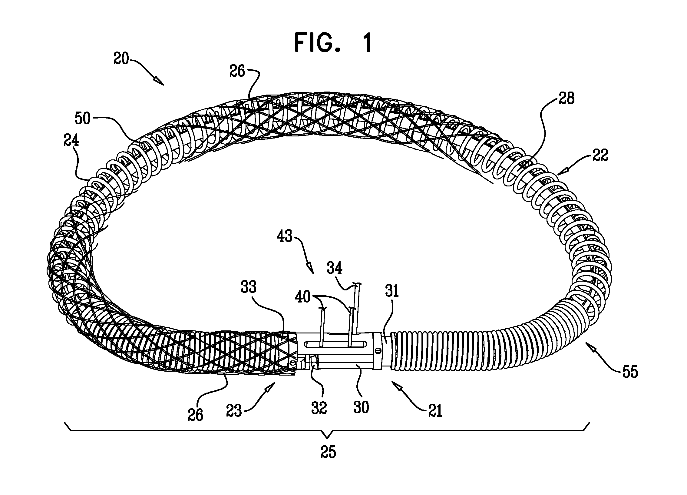 Actively-engageable movement-restriction mechanism for use with an annuloplasty structure