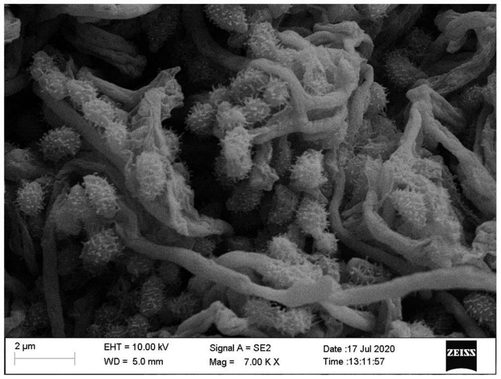 Streptomyces diastatochromogenes capable of resisting banana wilt and application of streptomyces diastatochromogenes