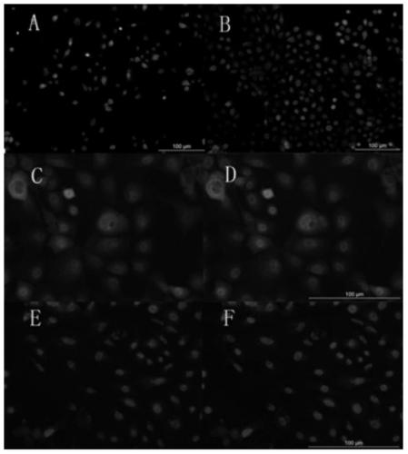 Culture medium and method for inducing directional differentiation of embryonic stem cells into keratinocytes