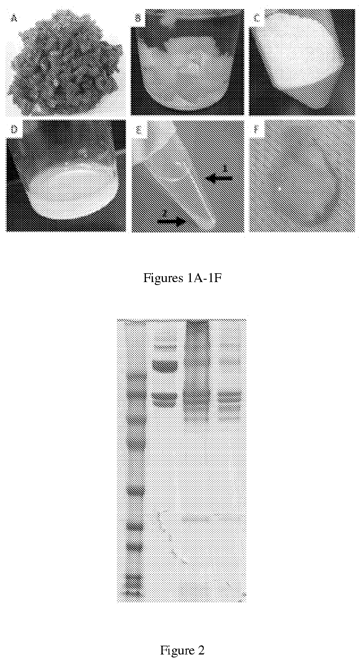 Soluble Extracellular Matrix Composition and Method for Intravascular Delivery