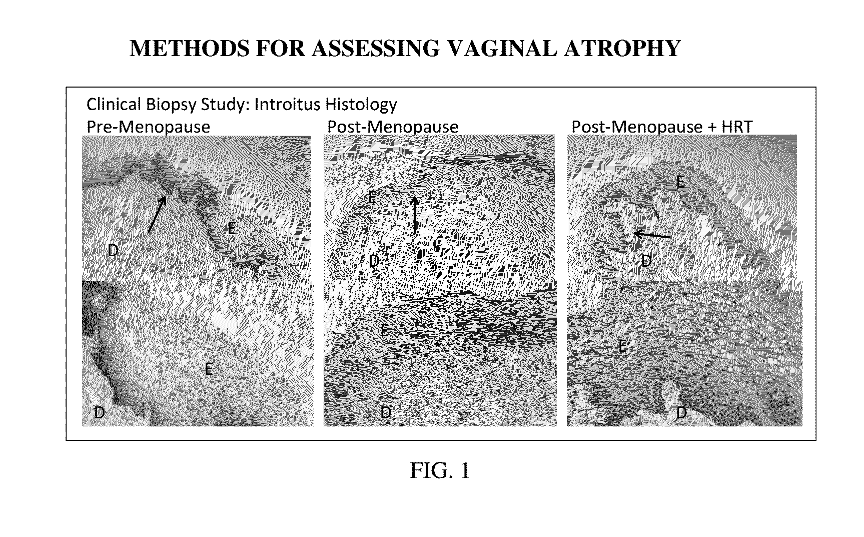 Methods for assessing vaginal atrophy