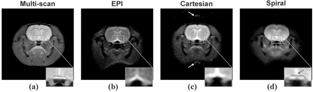 SPEN single-scanning magnetic resonance imaging spiral sampling and reconstructing method