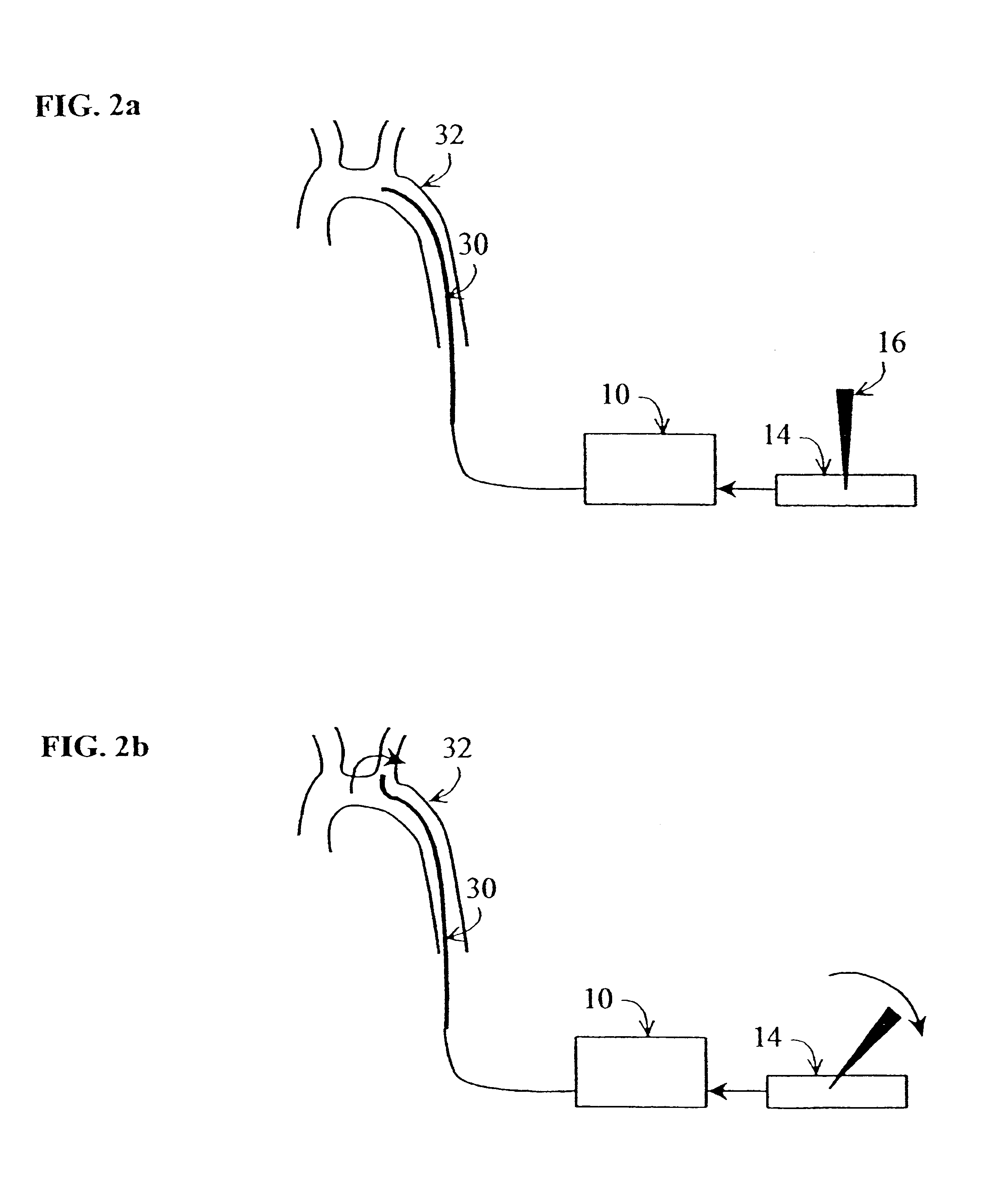 Method and apparatus for generating controlled torques on objects particularly objects inside a living body