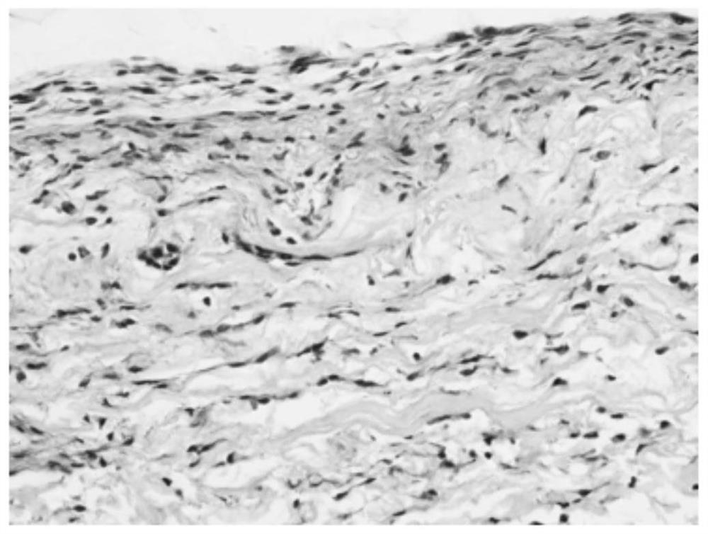 Soft tissue repair biological material and preparation method thereof