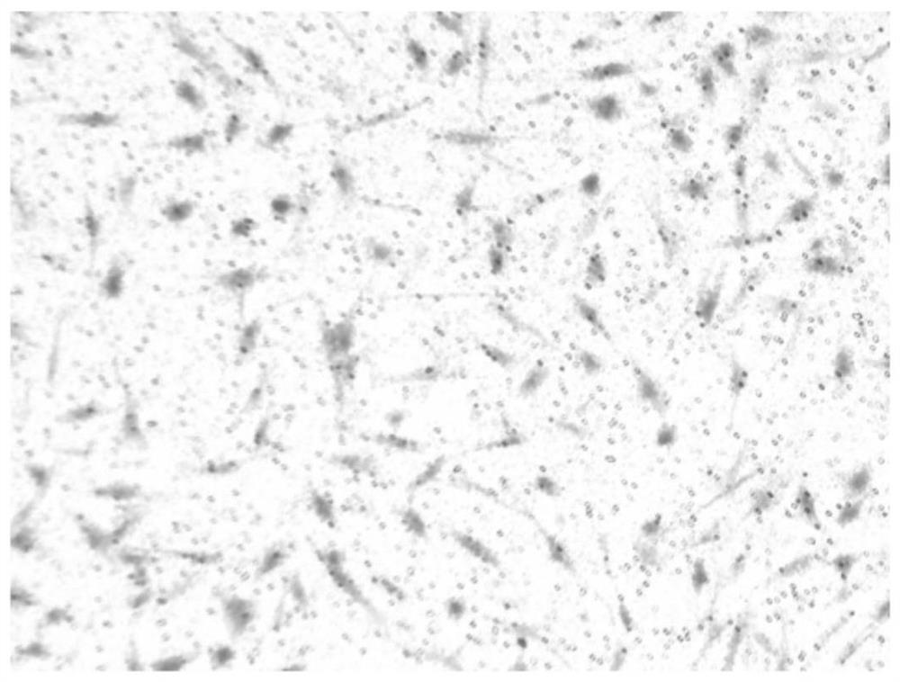 Soft tissue repair biological material and preparation method thereof