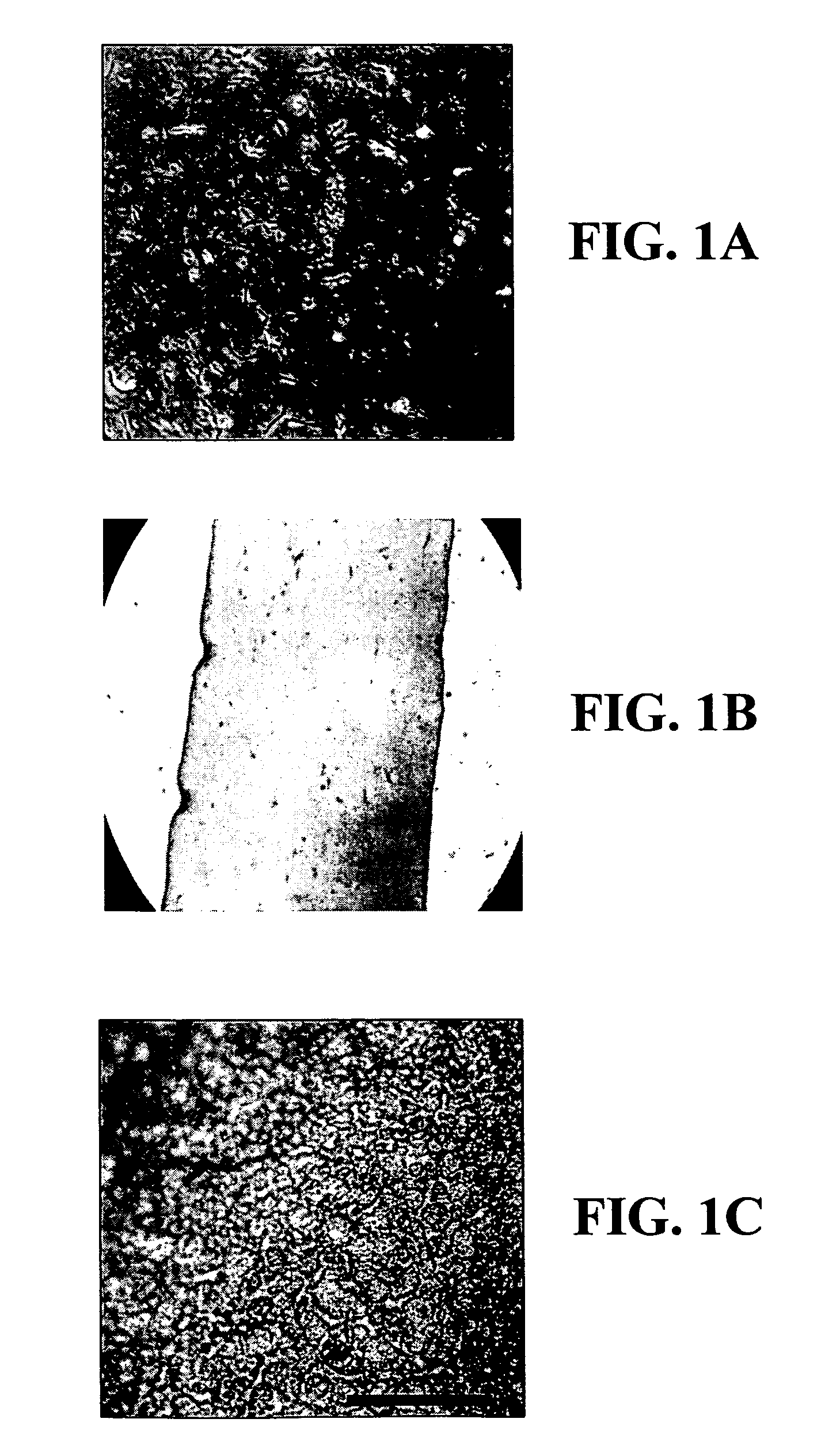 Corneal implant and uses thereof