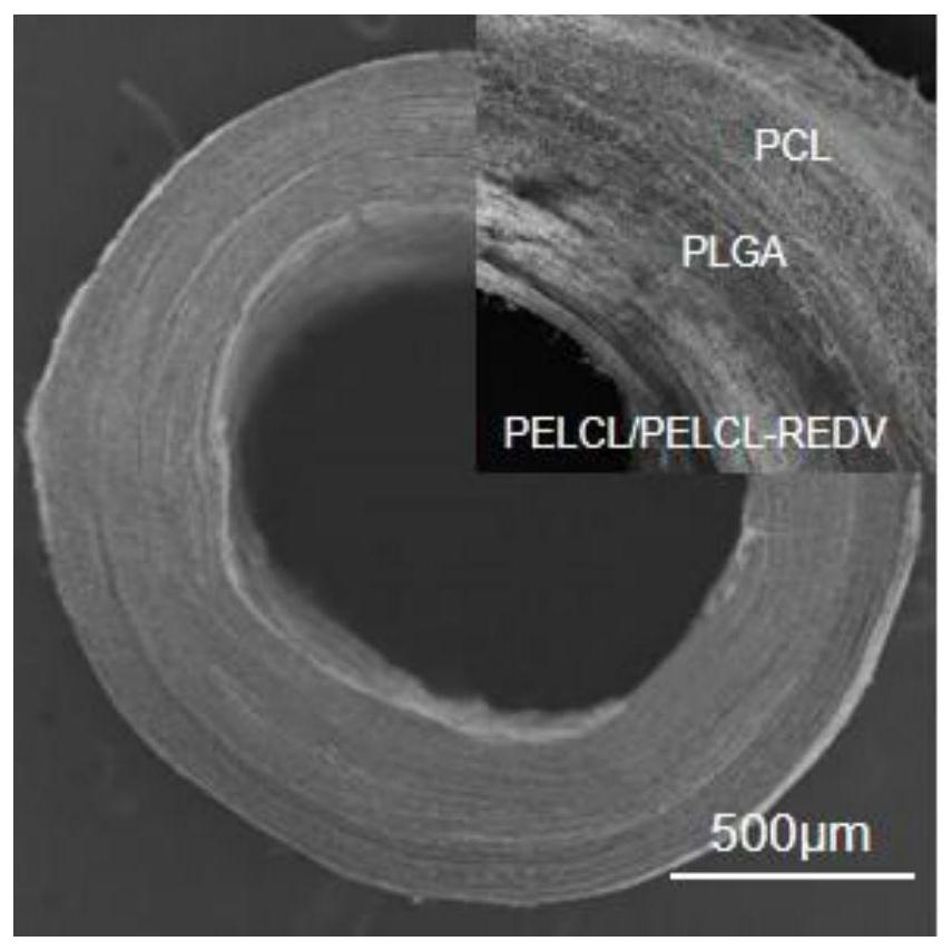 Three-layer artificial blood vessel electrospun membrane loaded with tiny nucleic acids and its preparation method and application