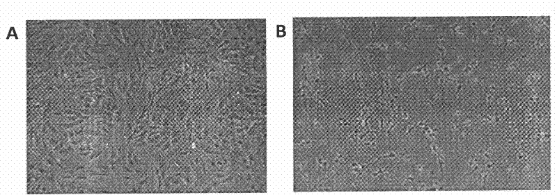 Development of oligodendrocyte progenitor cells prepared by differentiating mesenchymal stem cells through eleutheroside and kit, and medicine for nerve system disease