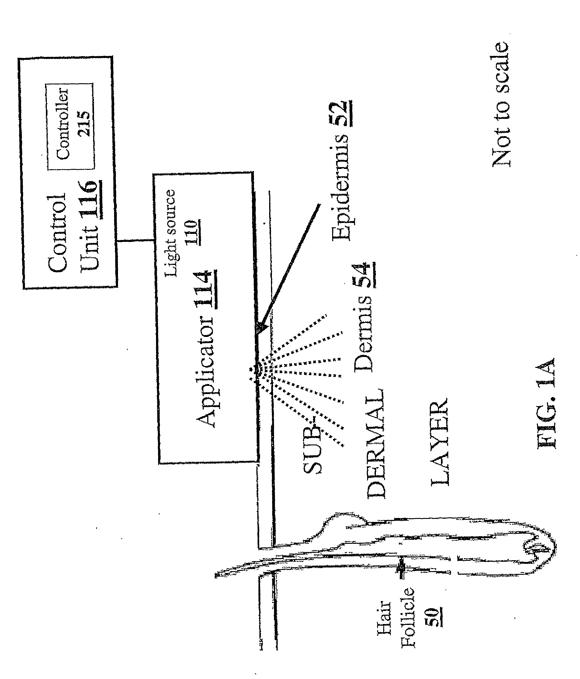 Method and apparatus for light-based hair removal