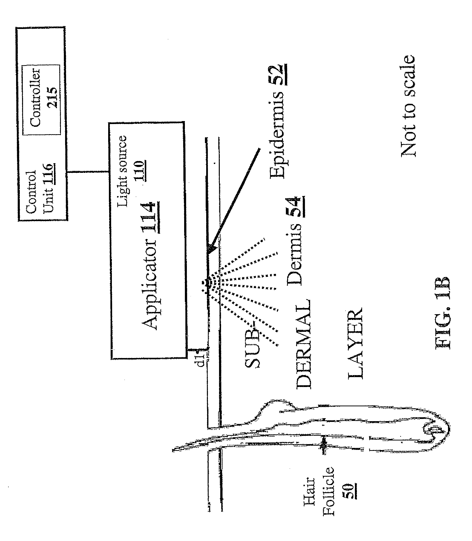 Method and apparatus for light-based hair removal