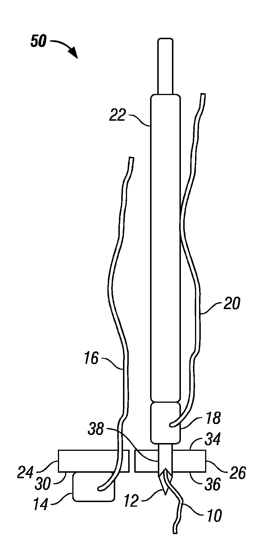 Needle-electrode and tissue anchor system