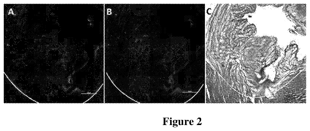 Methods of tissue repair and regeneration