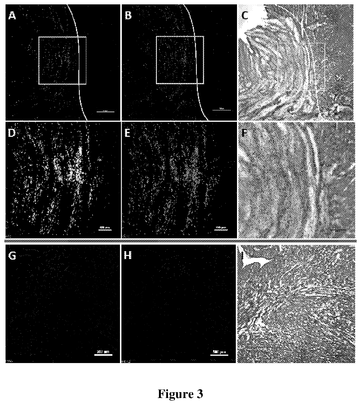 Methods of tissue repair and regeneration