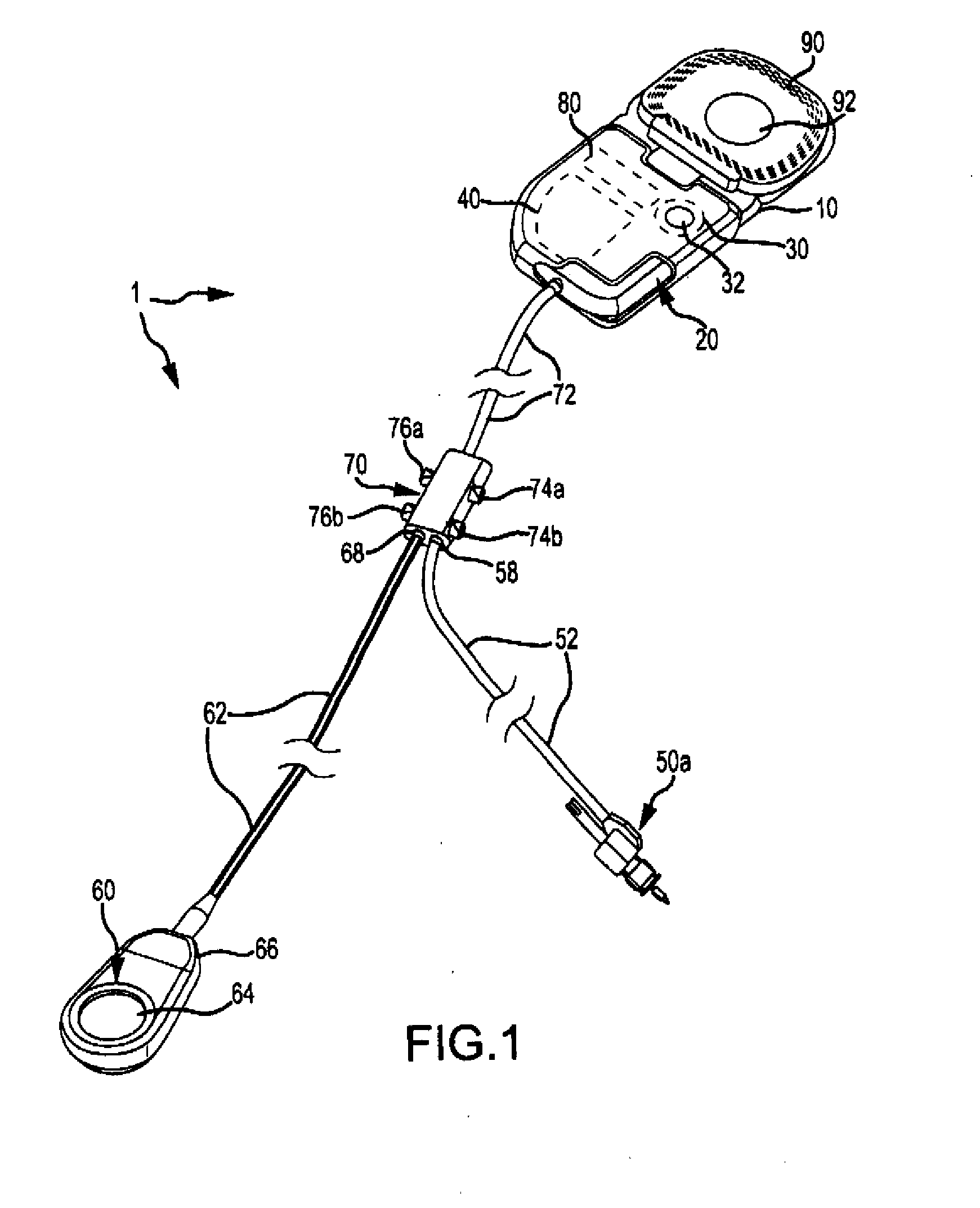 Implantable auditory stimulation system and method with offset implanted microphones
