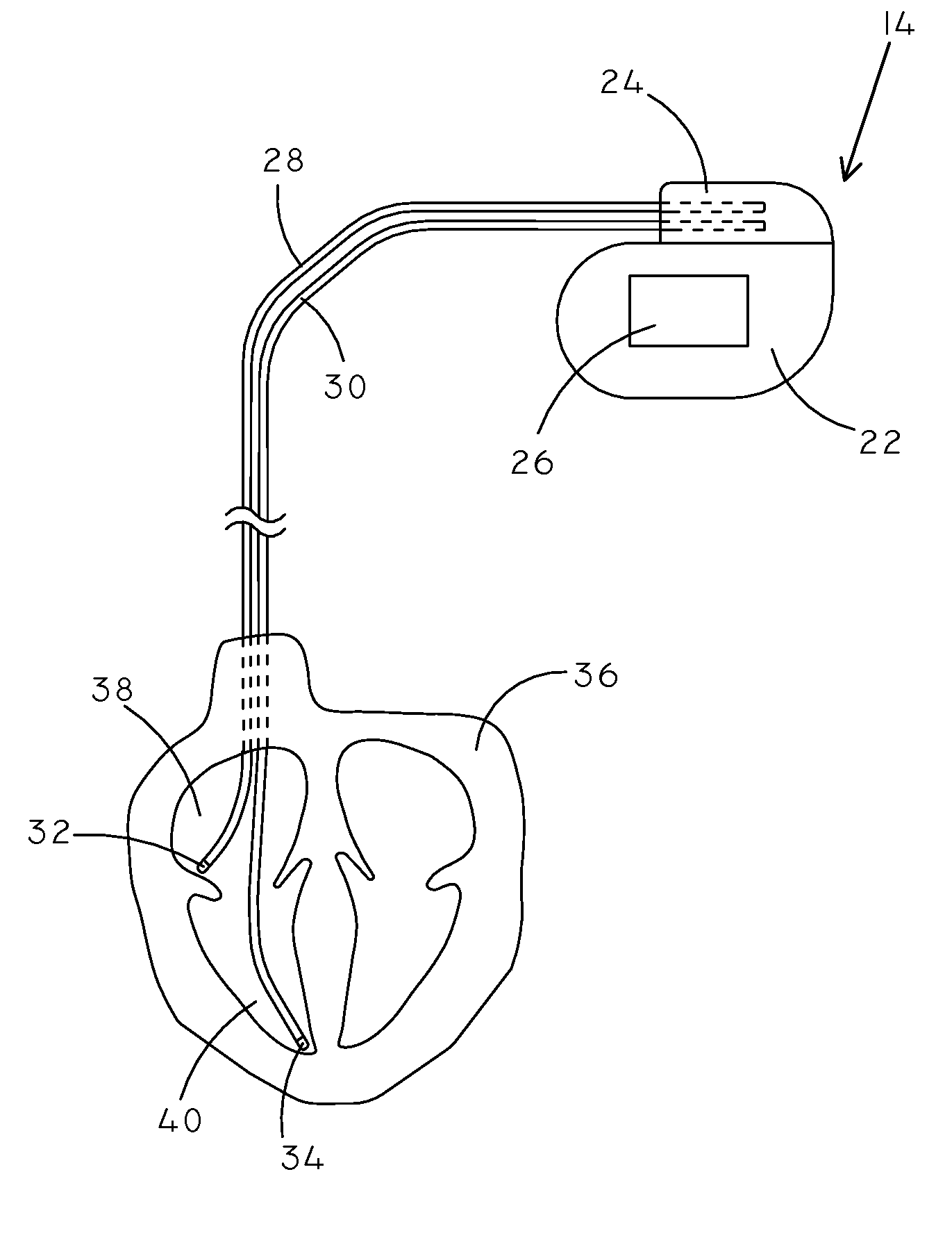Devices and methods for respiration therapy
