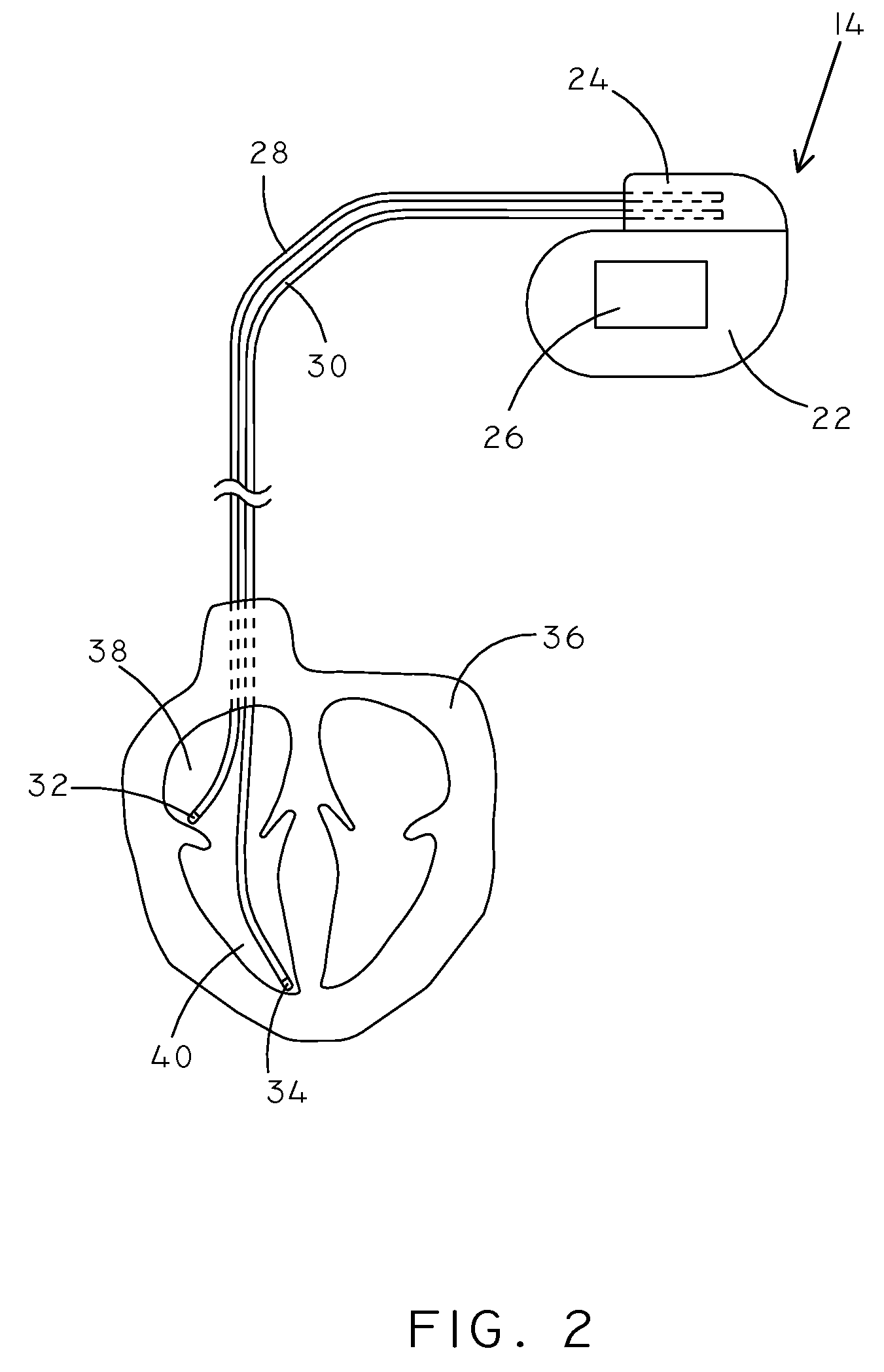 Devices and methods for respiration therapy
