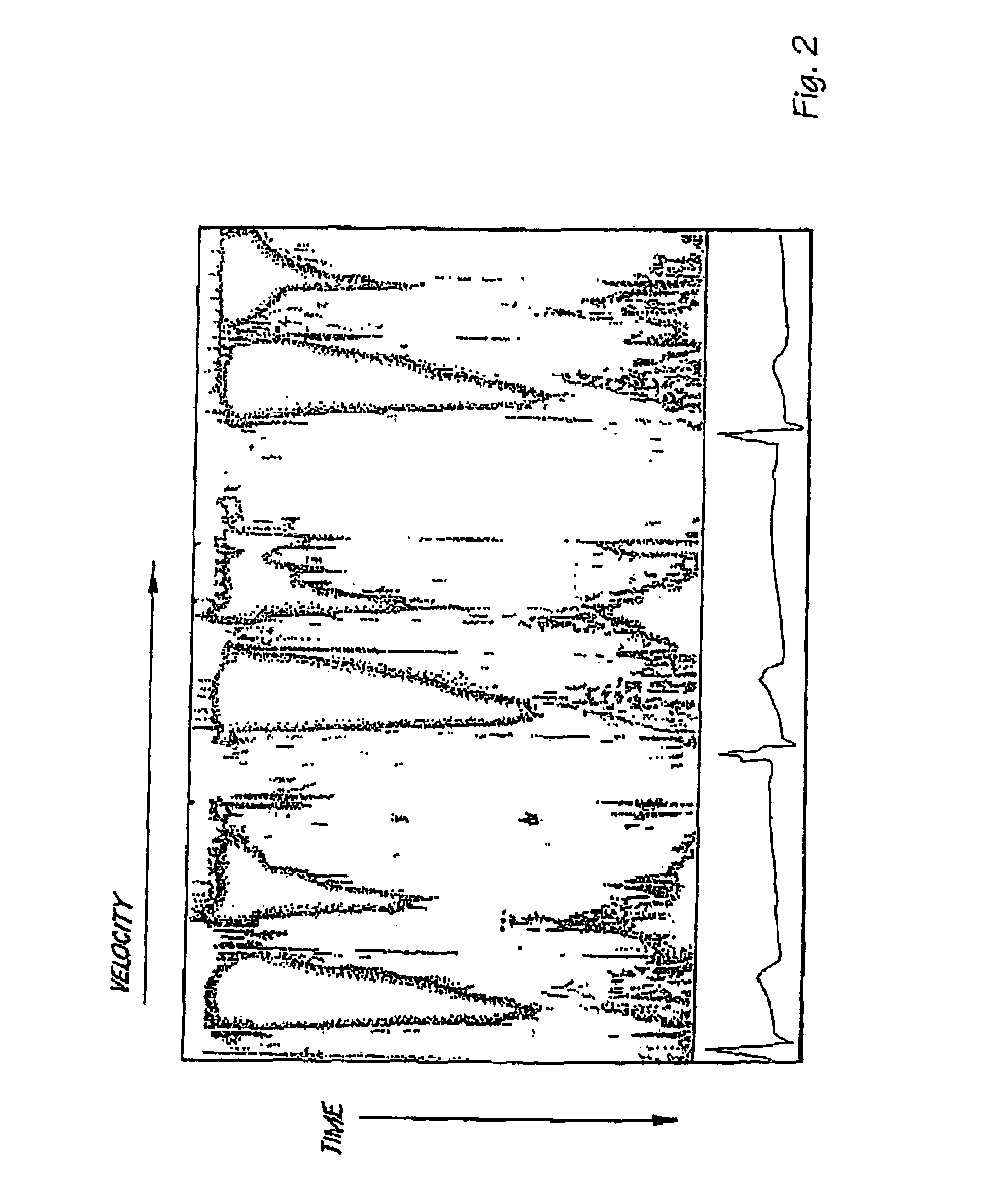 Methods and systems for determining cardiac output based on a valve cross sectional area estimate