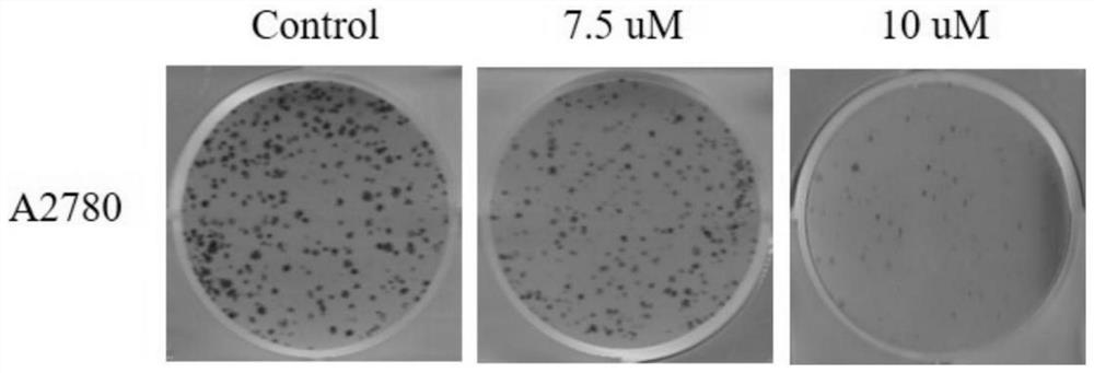 Application of oxfendazole as anti-ovarian cancer drug