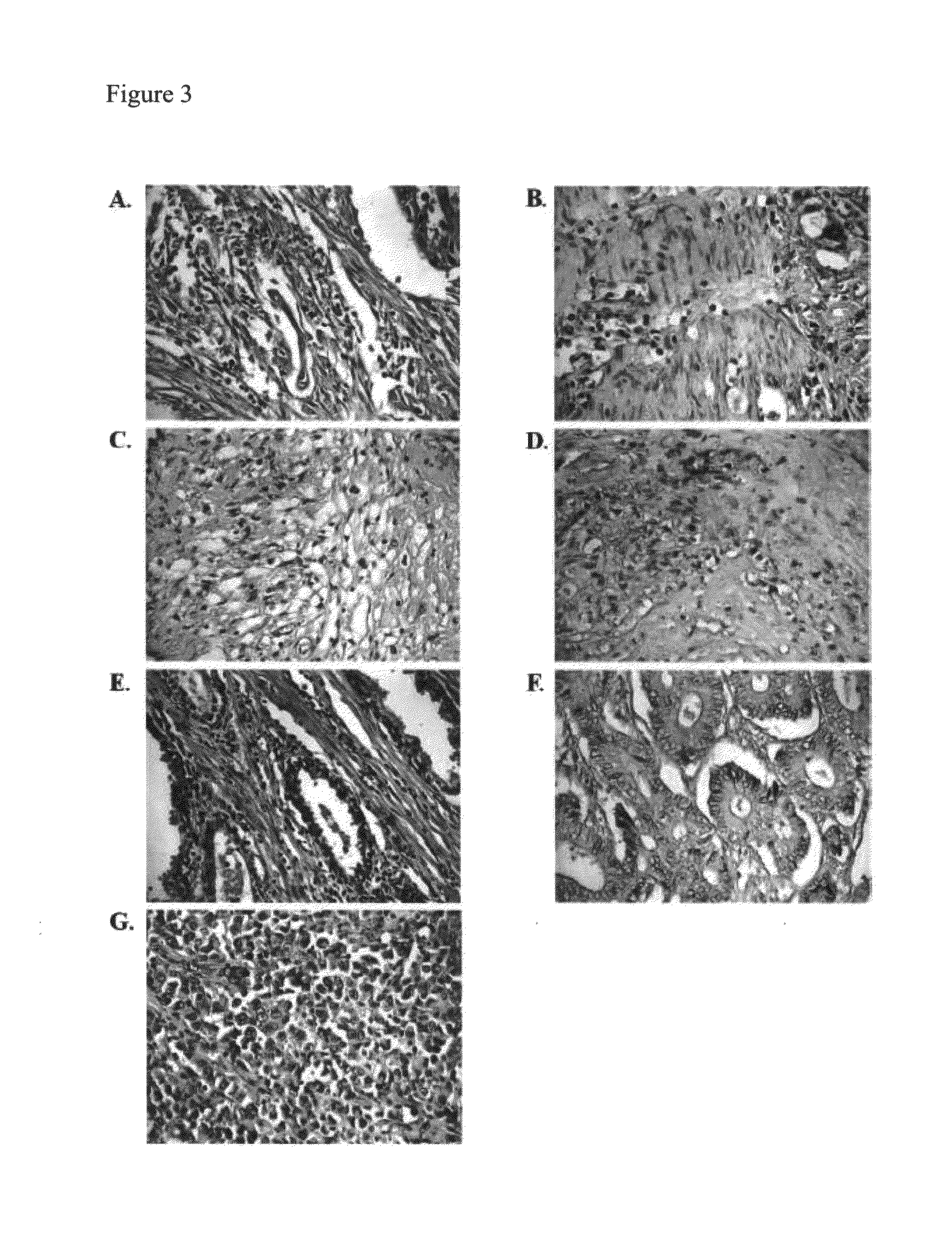 Kit and method of use of targeting peptide for diagnosis and therapy of cancer