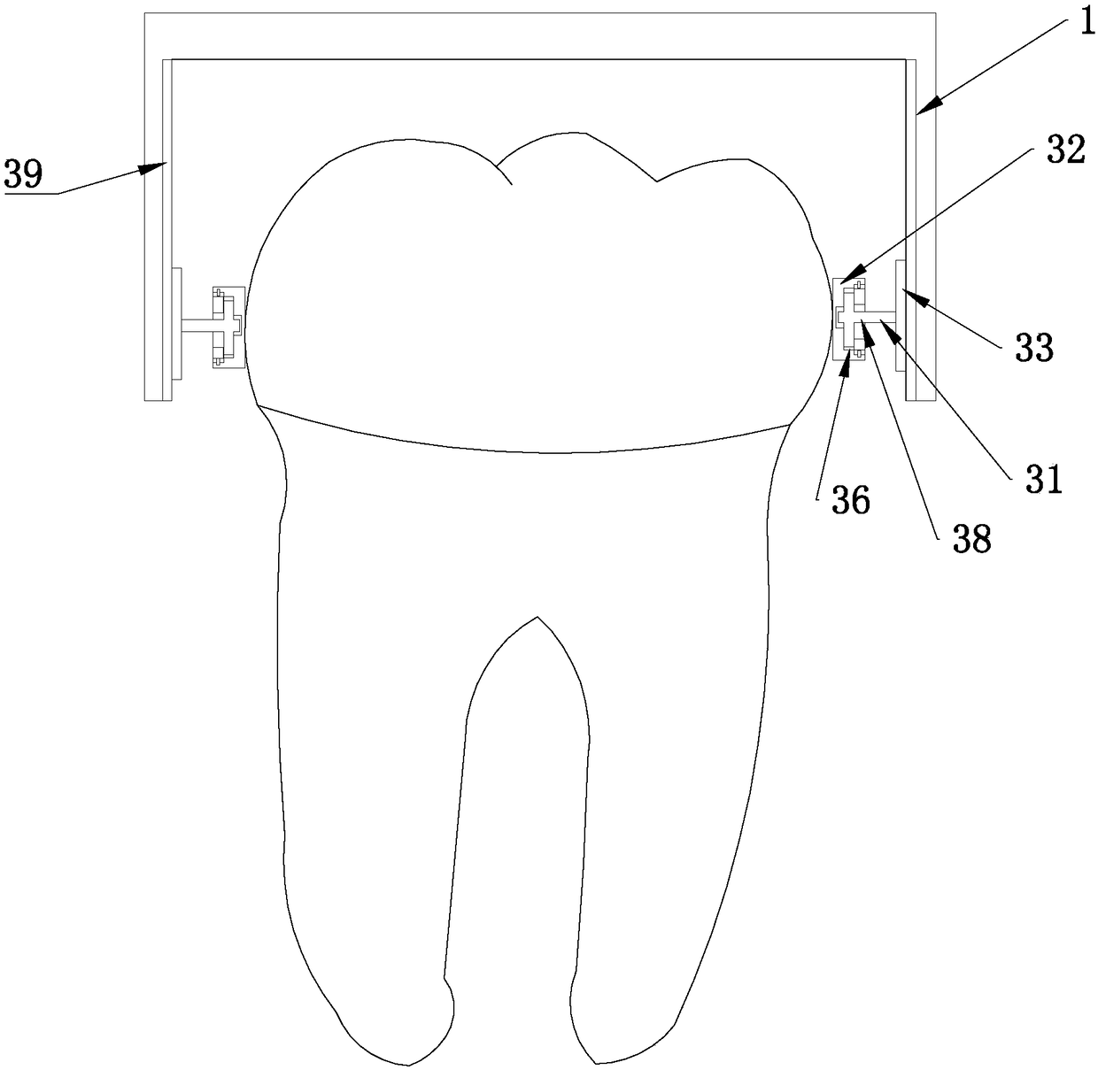 Boning and tooth separation device for impacted tooth extraction