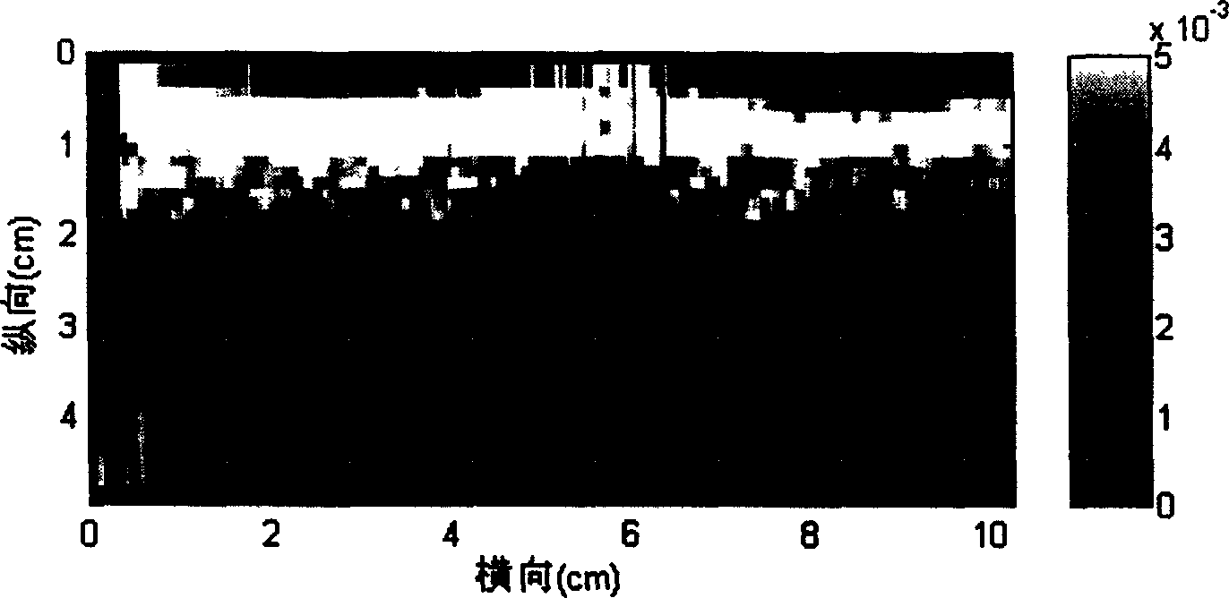 Balance pressure detector of supersonic elastic imaging