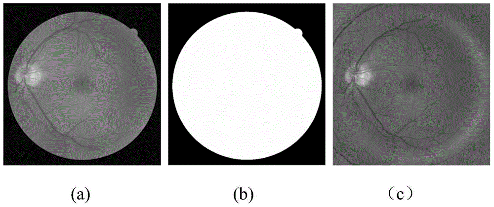 Quick optic disc positioning method based on multi-scale macula detection