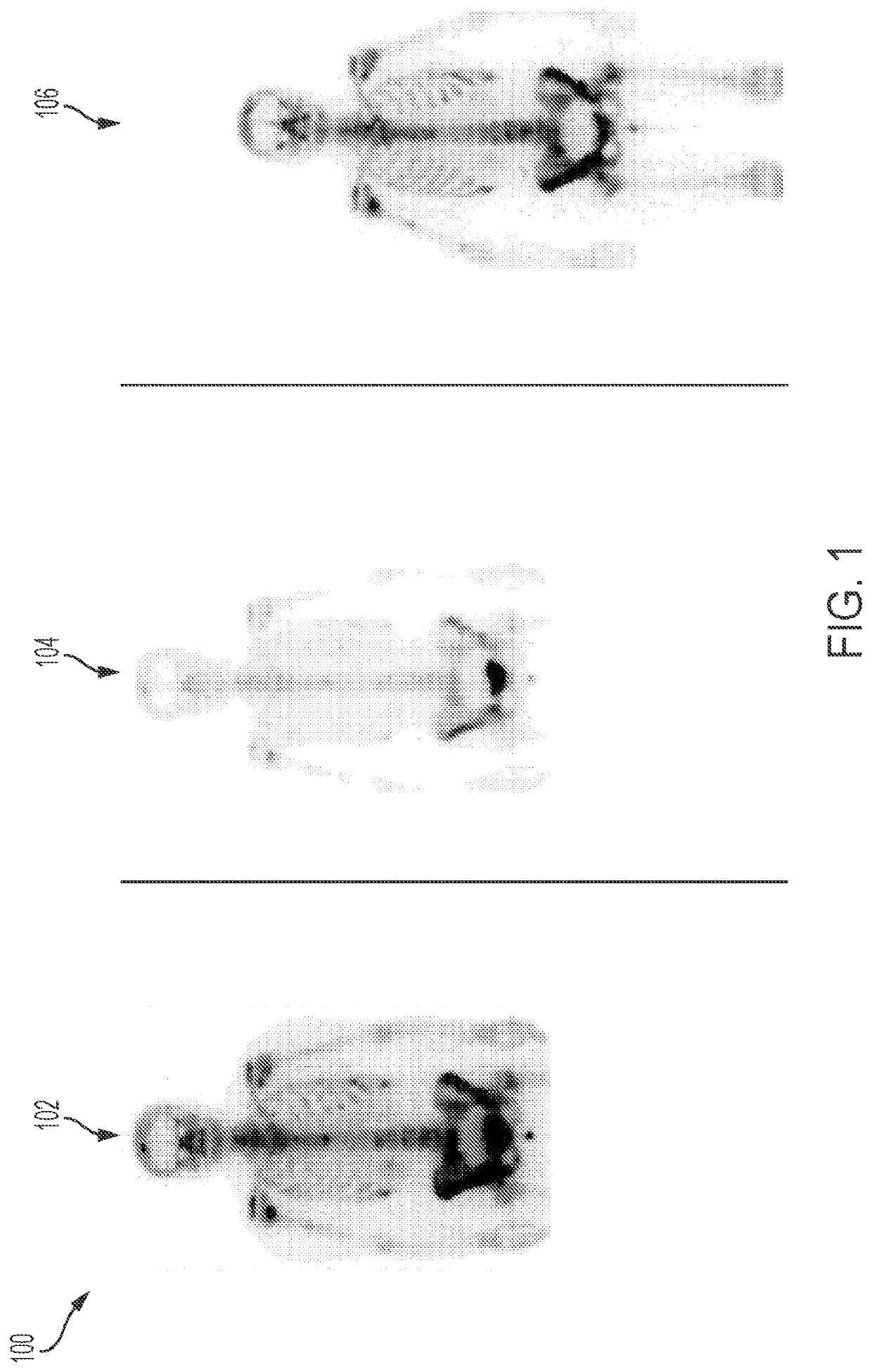 Systems and methods for interactive adjustment of intensity windowing in nuclear medicine images