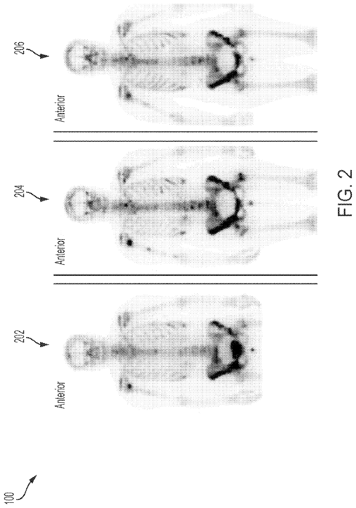 Systems and methods for interactive adjustment of intensity windowing in nuclear medicine images