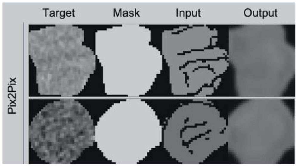 Liver tumor image sample augmentation method based on generative adversarial network