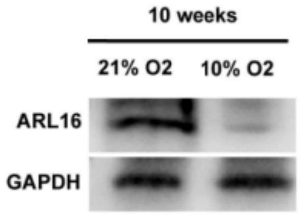 Application of ARL16 protein agonist in sperm flagellum multiple morphological abnormality under hypoxia