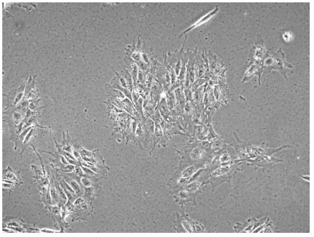 Rapid induced differentiation method of mesenchymal stem cells, kit and application of rapid induced differentiation method