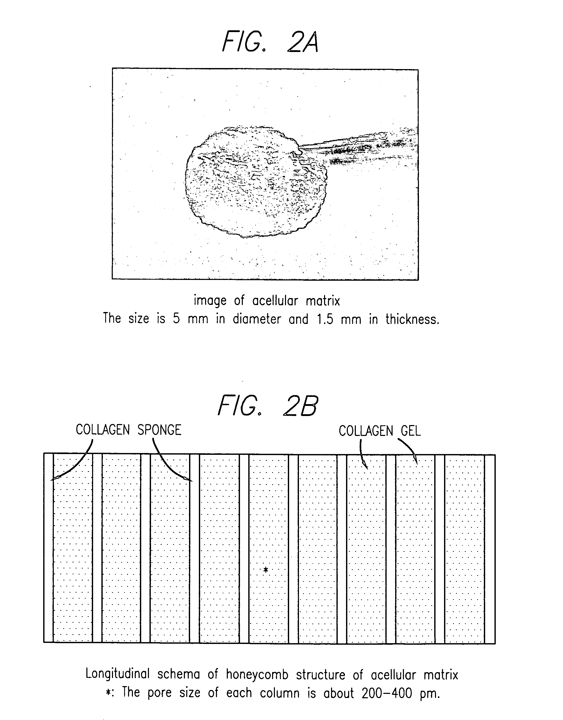 Biocompatible tissue sealant for treatment of osteochondral and bone defects using an acellular matrix implant