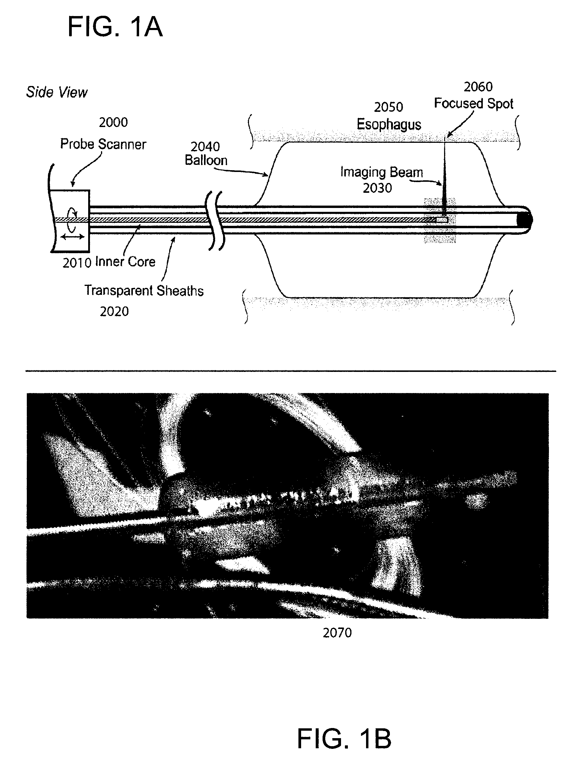 Methods and systems for providing electromagnetic radiation to at least one portion of a sample using conformal laser therapy procedures