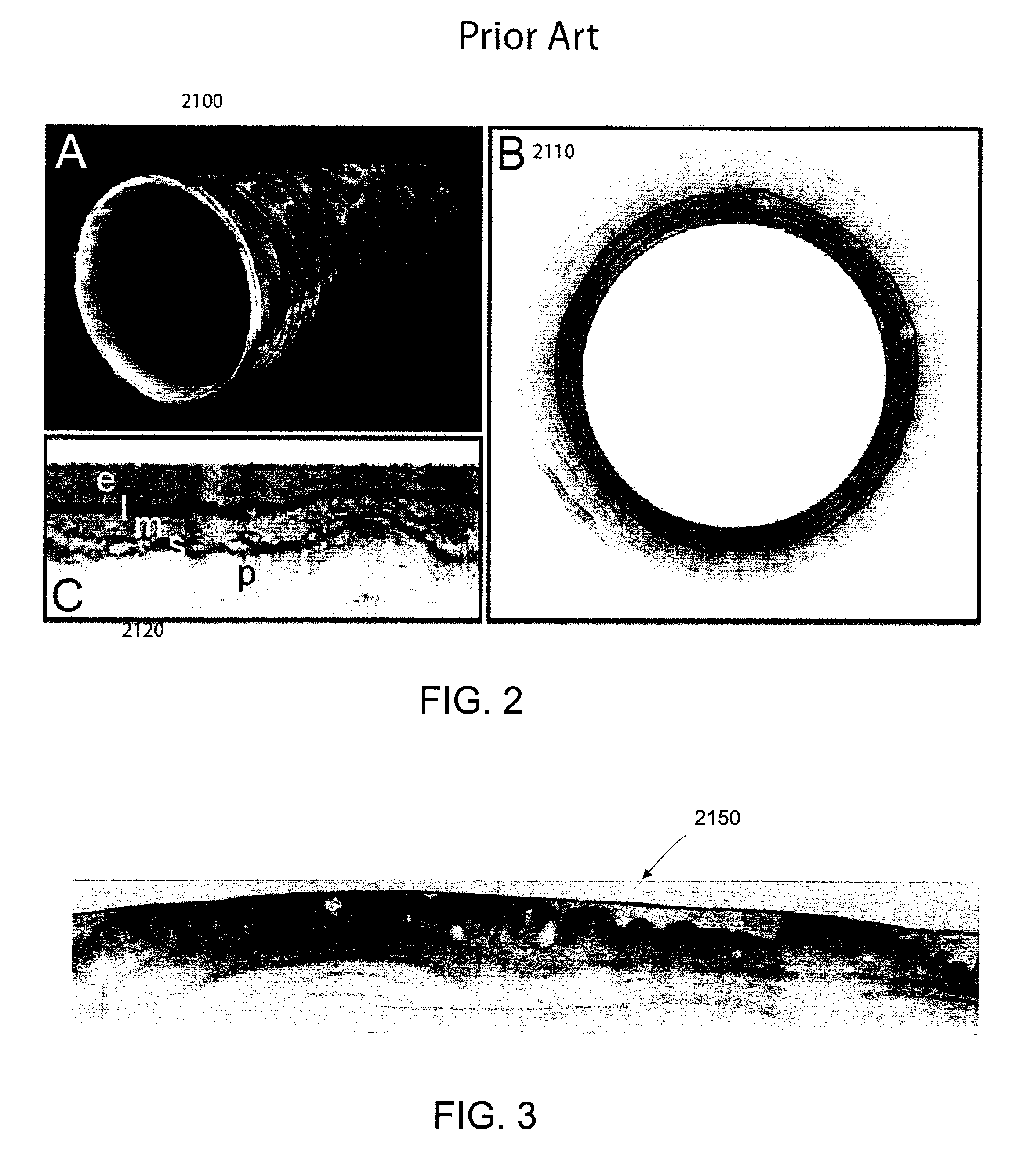 Methods and systems for providing electromagnetic radiation to at least one portion of a sample using conformal laser therapy procedures