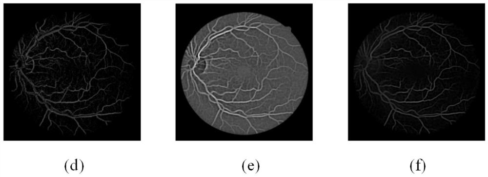 Retinal vessel segmentation method and device based on guided filtering