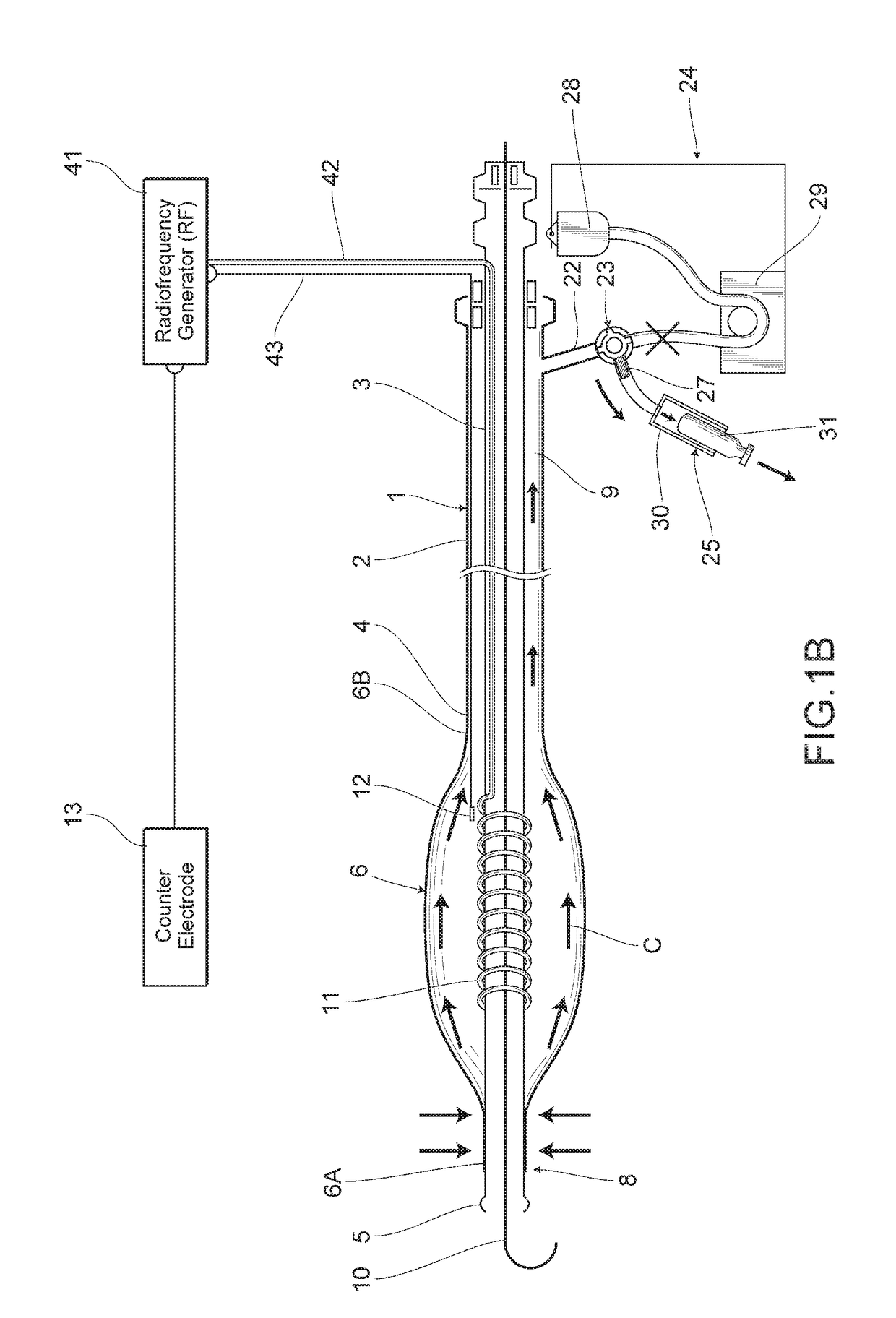 Radiofrequency balloon catheter system