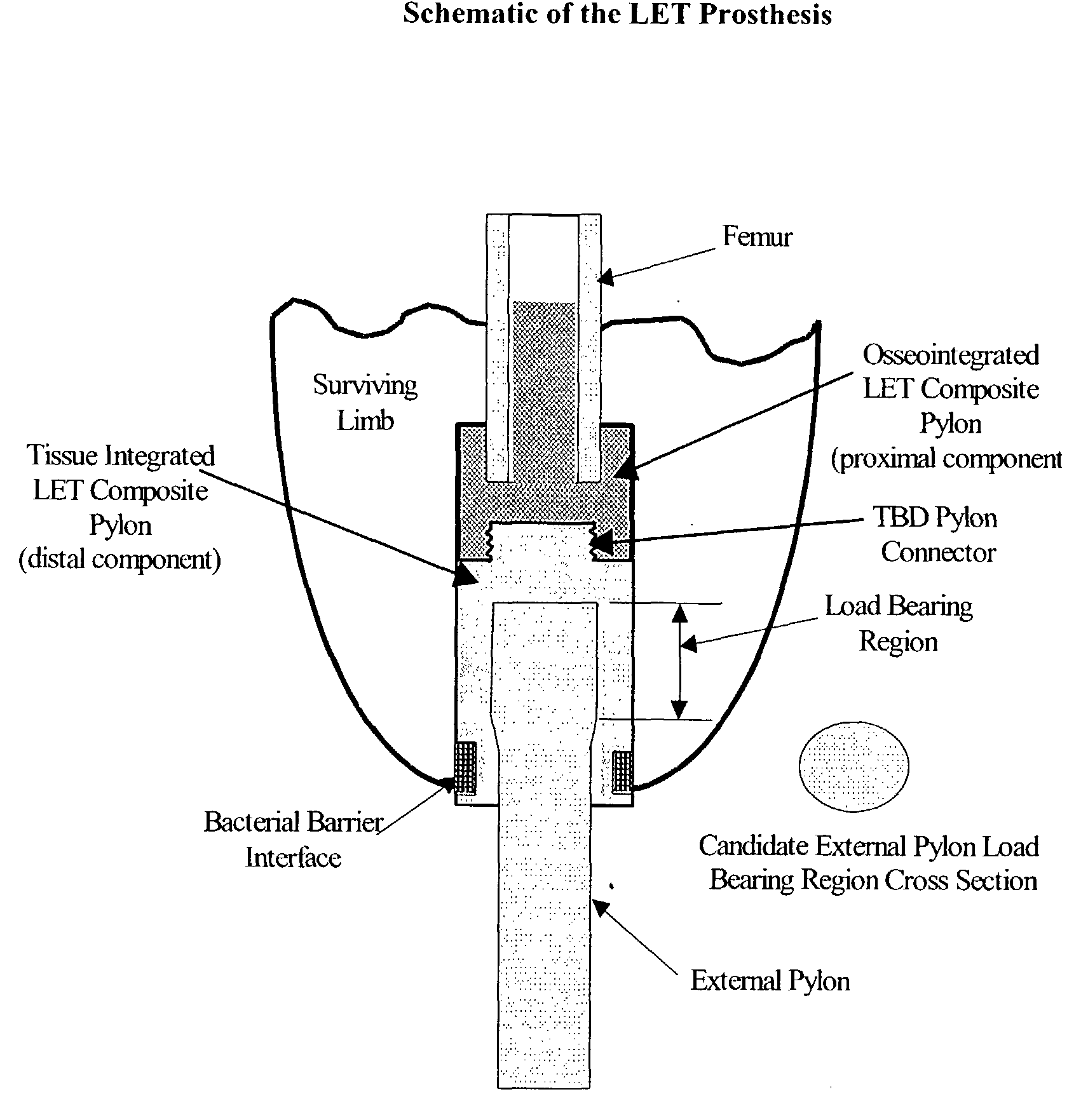 Wound Closure System and Methods