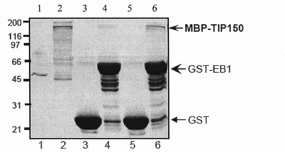 Microtubule-associated protein and coding genes and application thereof