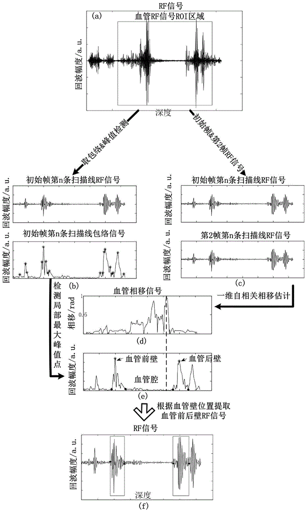 Method for measuring local pulse wave propagation speed of carotid blood vessel