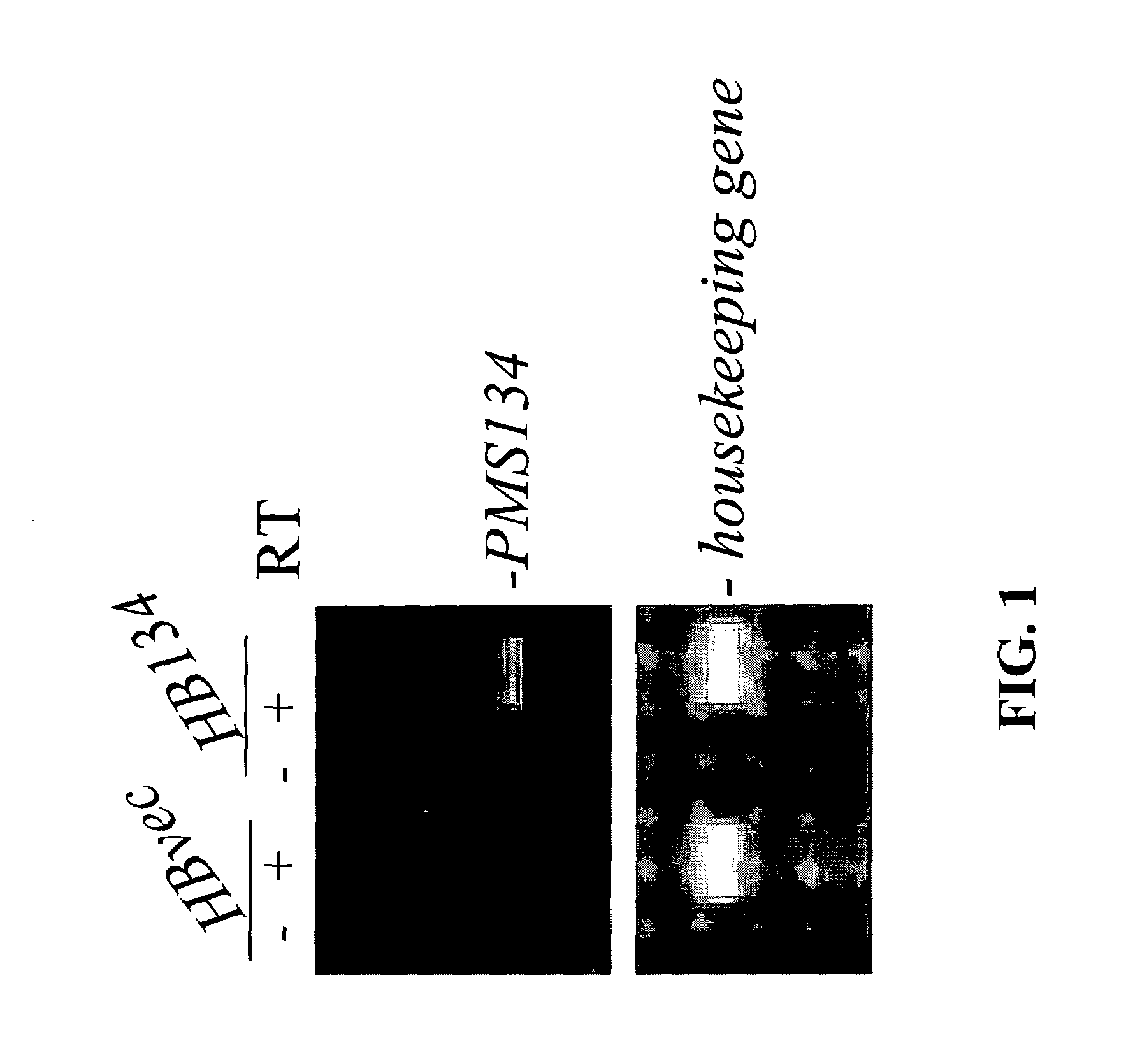 Genetically altered antibody-producing cell lines with improved antibody characteristics