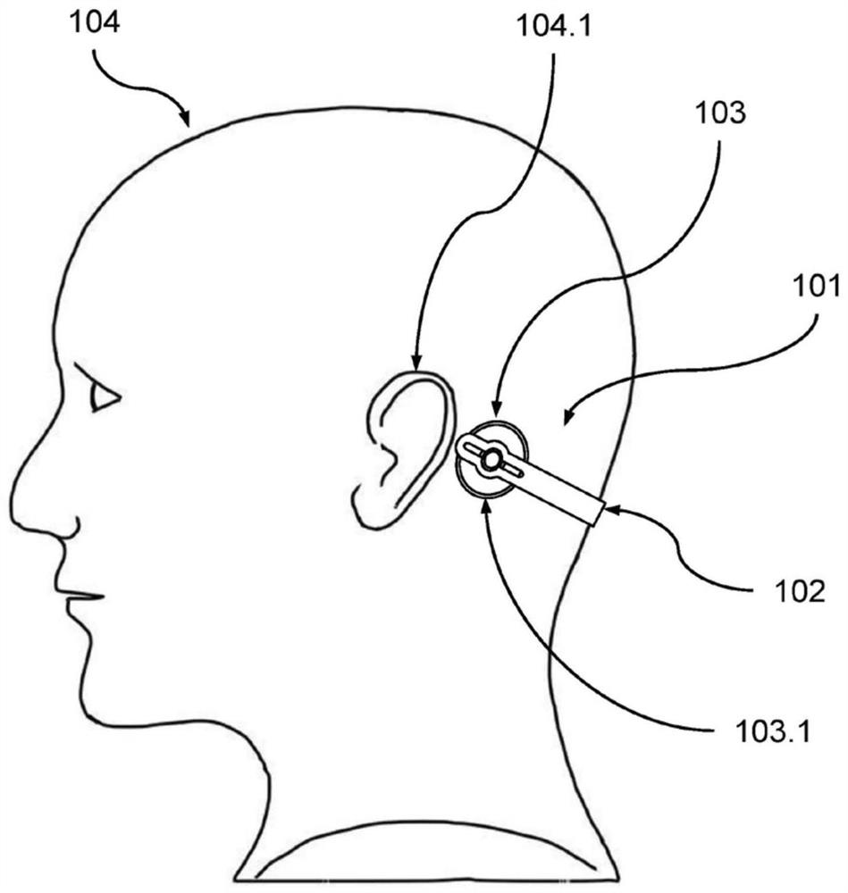 Hearing system to be worn at head of user