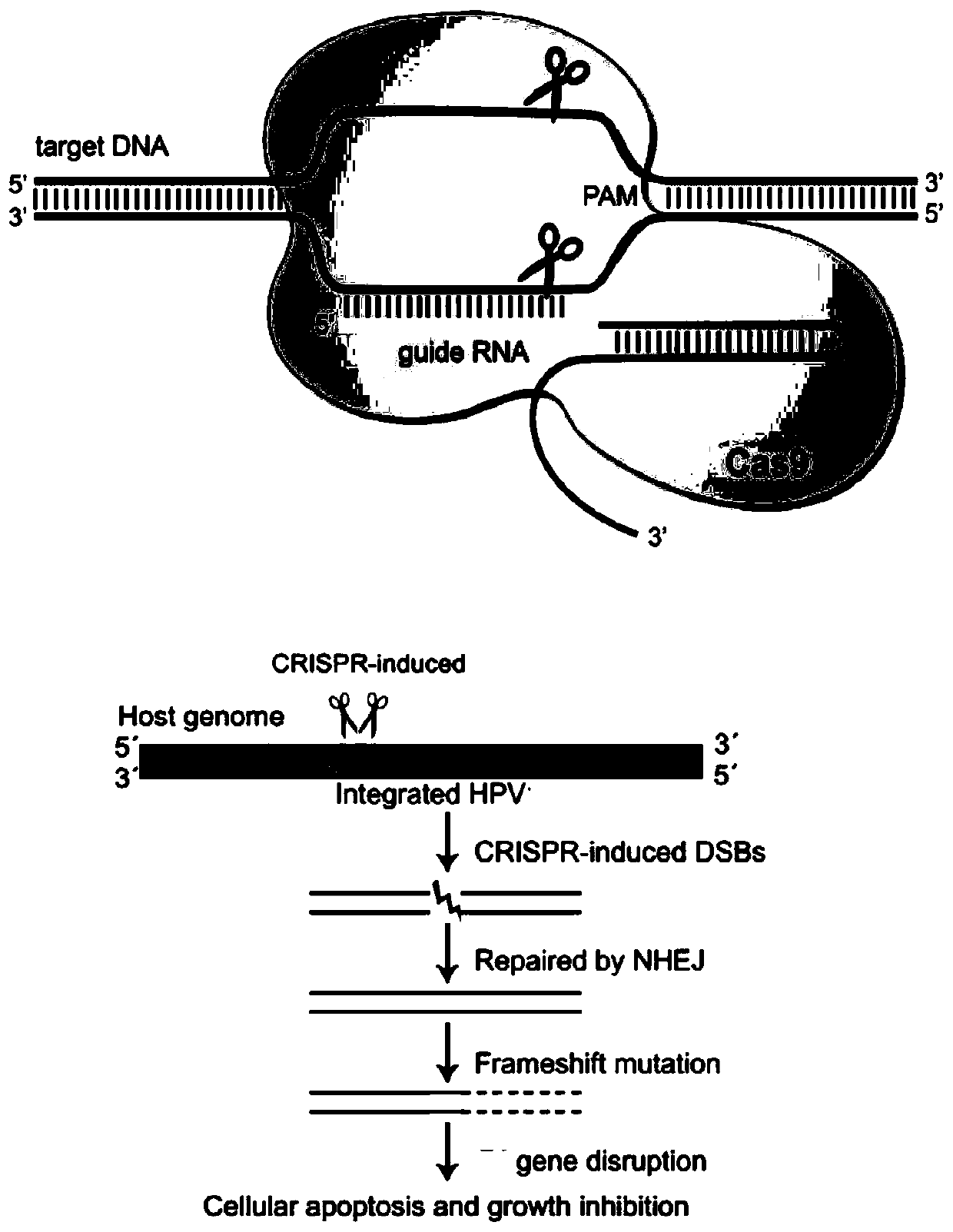 Plasmid, system and preparation for targeted knockout of human papilloma virus (HPV) URR (upstream regulatory region) genes and preparation method of plasmid, system and preparation