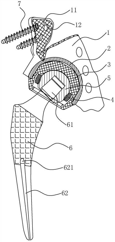 Double-acting pelvic dog joint prosthesis