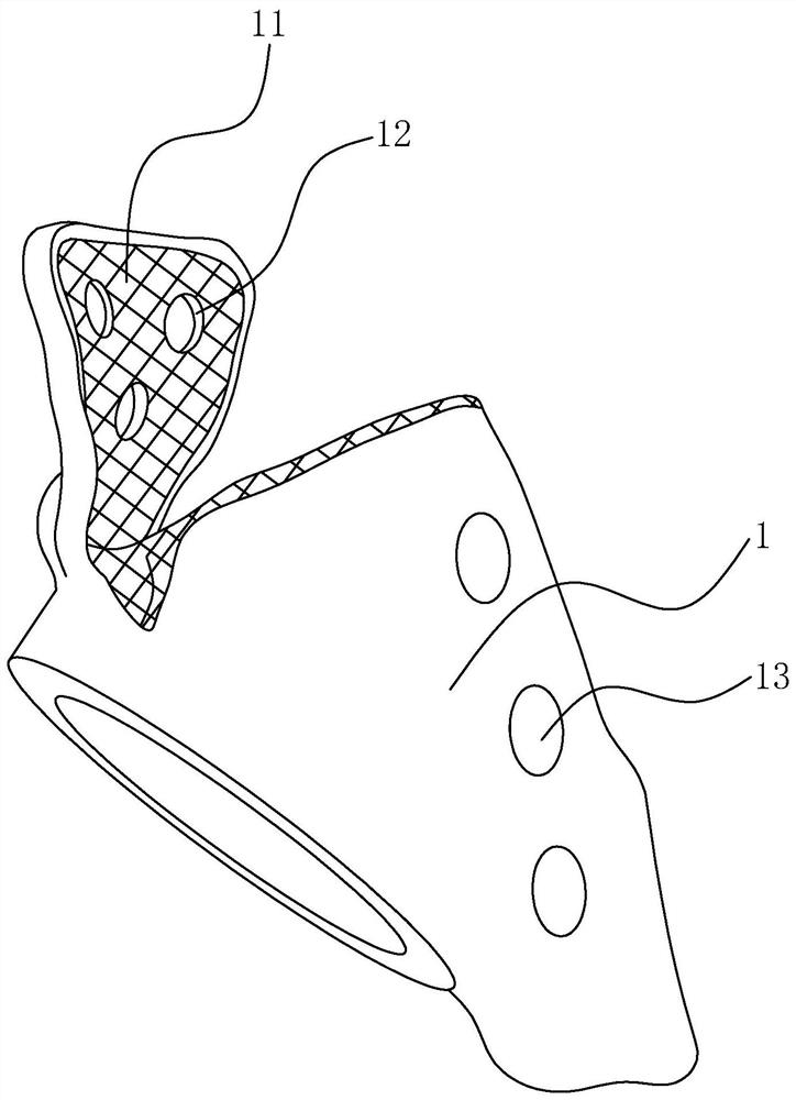 Double-acting pelvic dog joint prosthesis