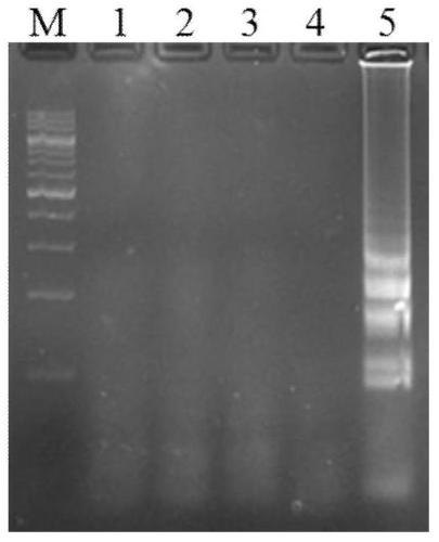 A kind of abacavir individualized drug detection kit and method thereof