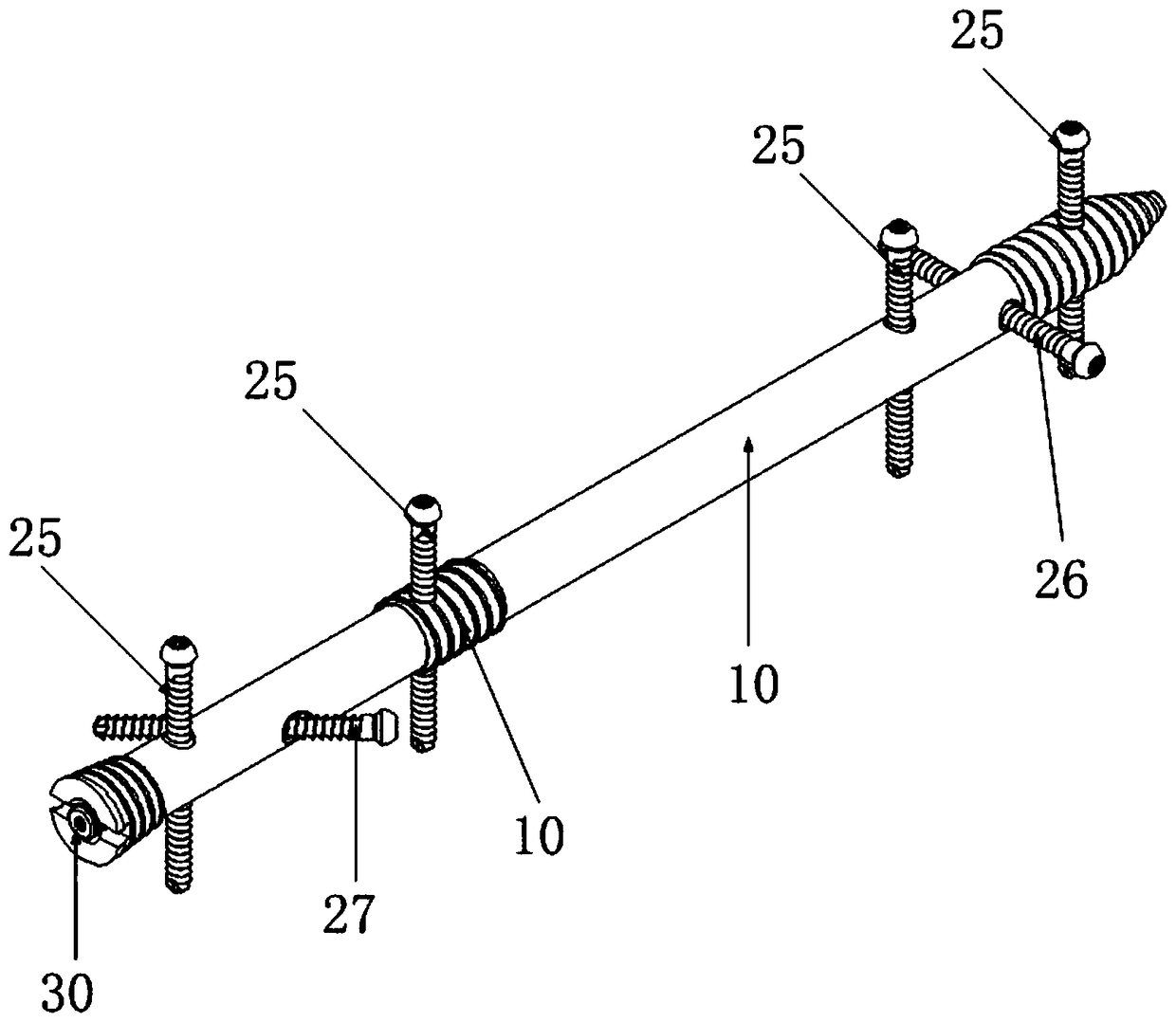 Foot-ankle fusion structure and joint fusion device